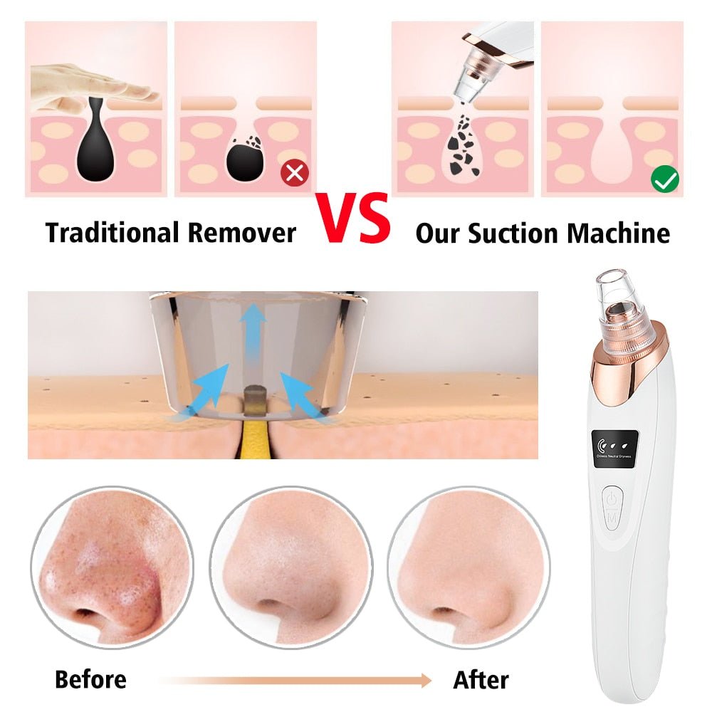 Vacuum Electric Blackhead Remover Cleaner | MODE BY OH