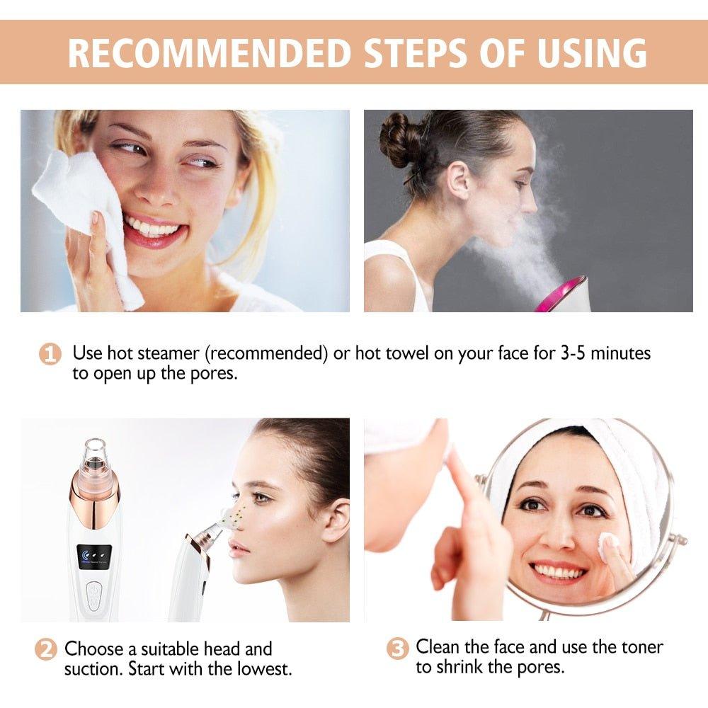 Vacuum Electric Blackhead Remover Cleaner - MODE BY OH